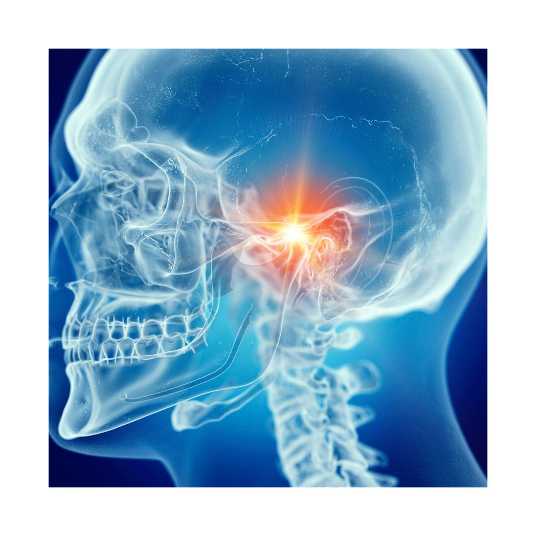 Esercizi per la fascite plantare Post Instagram Quadrato